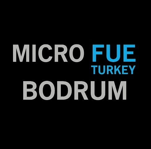 Micro FUE Turkey Bodrum hair transplant recovery experience with luxury hotel balcony sea view and peaceful post operation healing environment in Bodrum Turkey